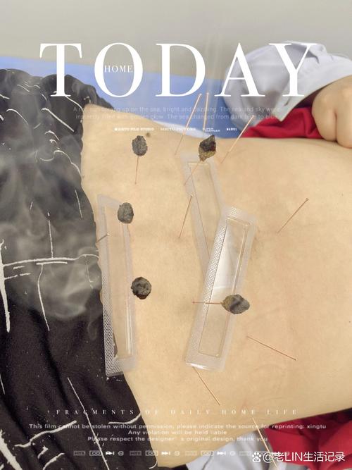 针灸治疗子宫内膜增厚