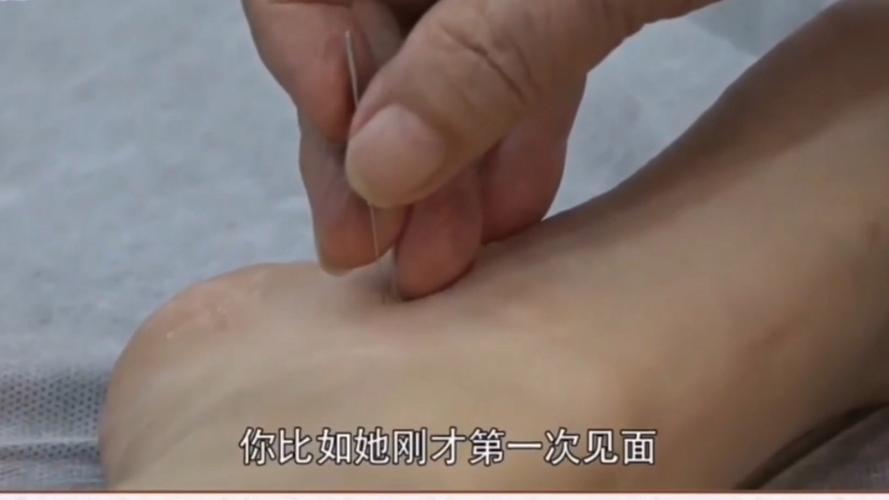 山西郭廷英针灸厉害吗