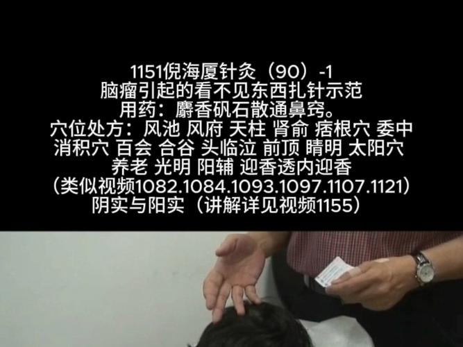 脑血管痉挛针灸有用吗