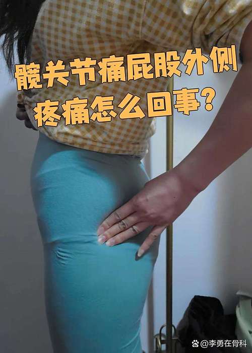 屁股髋关节痛是否痛风