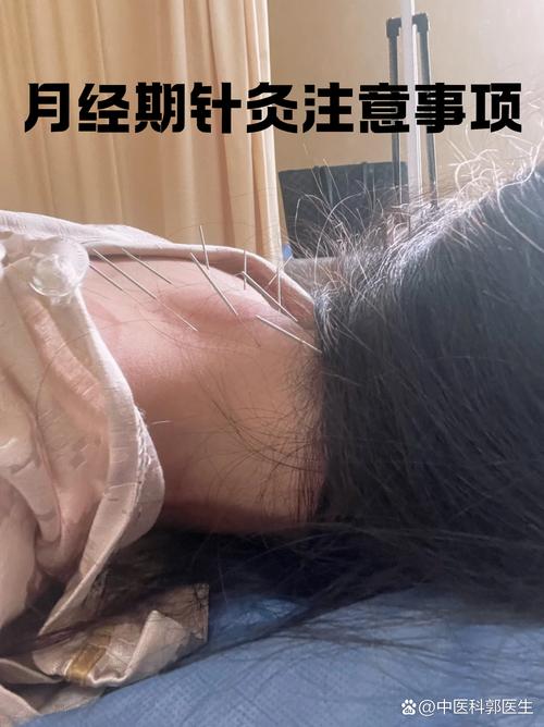扎针灸影响月经推迟吗