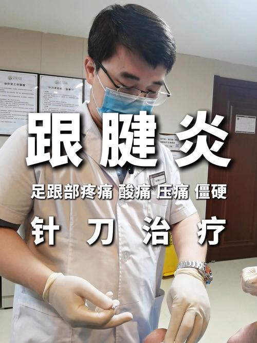 足跟痛的针灸治疗案例