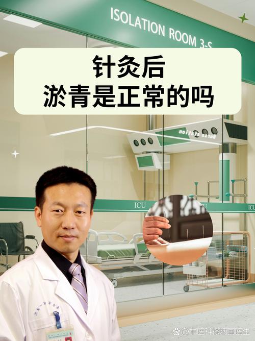 针灸会出现反复正常吗