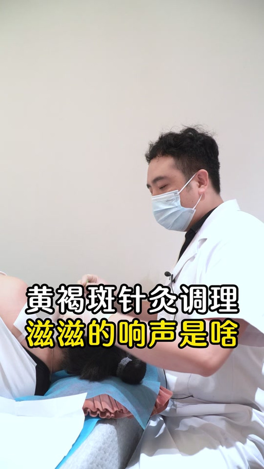 用针灸治疗斑秃的频率