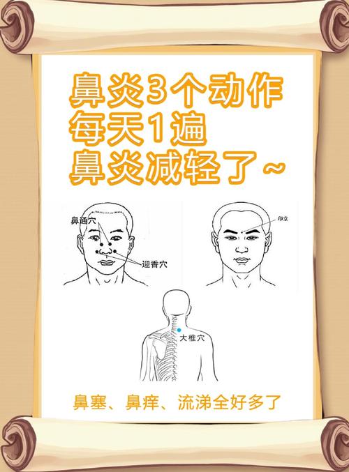 针灸治慢性鼻炎要多久