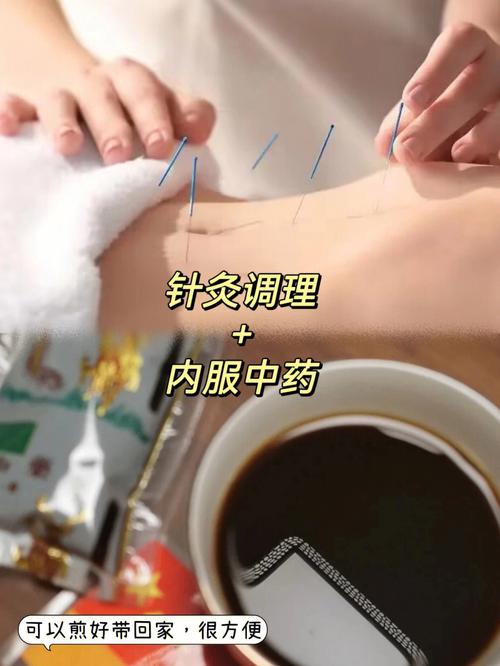 胃病针灸需要每天做吗