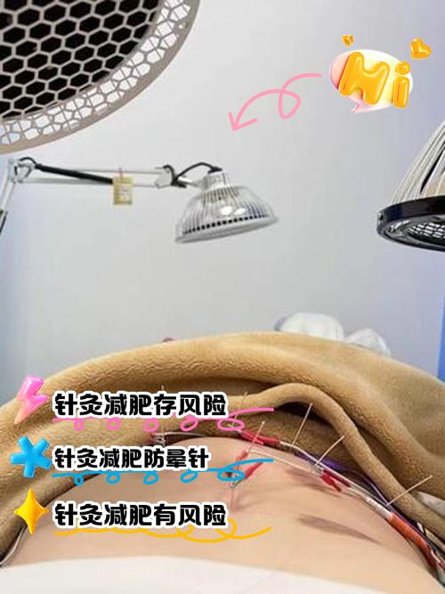 针灸减肥会推迟月经吗