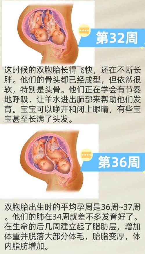 33周双胞胎算安全了吗