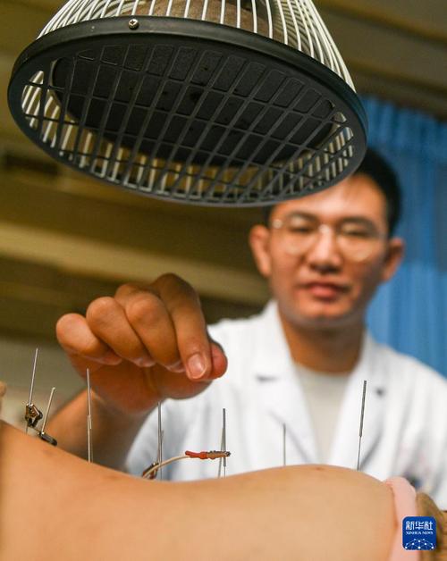 焦作好的针灸或者中医