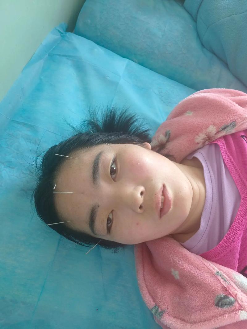 温州鸥海区哪里有针灸