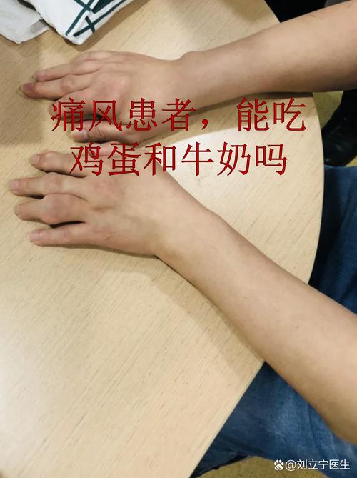 痛风患者能喝酸牛奶吗