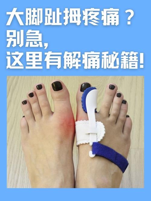 大脚趾痛风可以泡脚吗