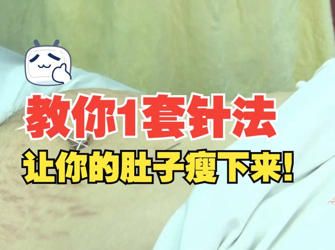 针灸减肥可以瘦肚子吗