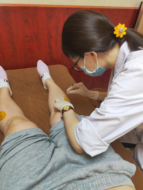 针灸减肥都扎哪里图片