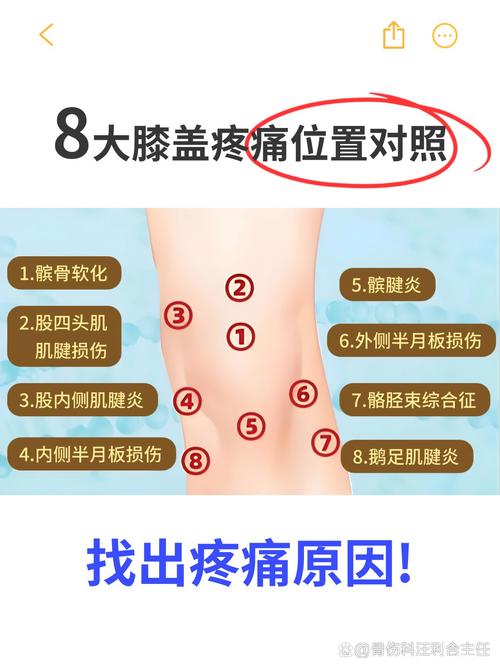 膝关节疼痛会是痛风吗