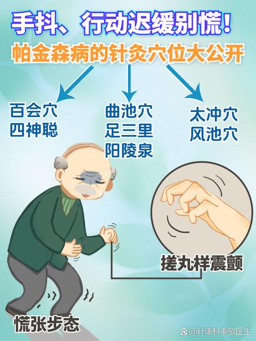 帕金森综合症针灸治疗