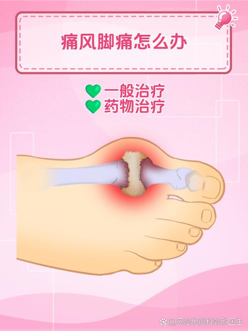 痛风脚反复肿痛怎么办