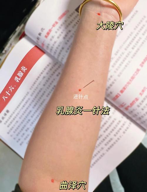 针灸能治疗乳腺结节吗