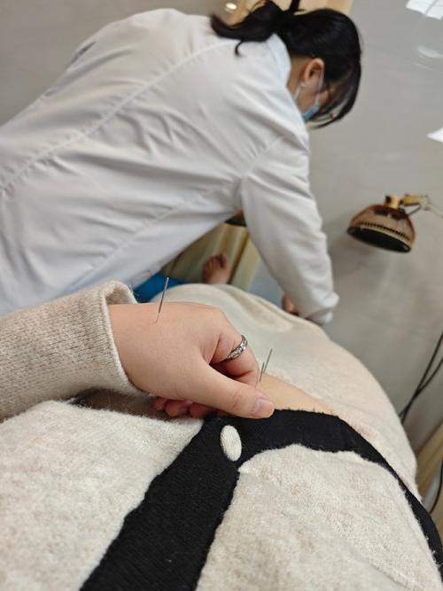 月经不调针灸效果怎样