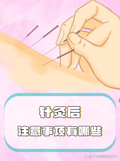 瘦胳膊好方法针灸减肥