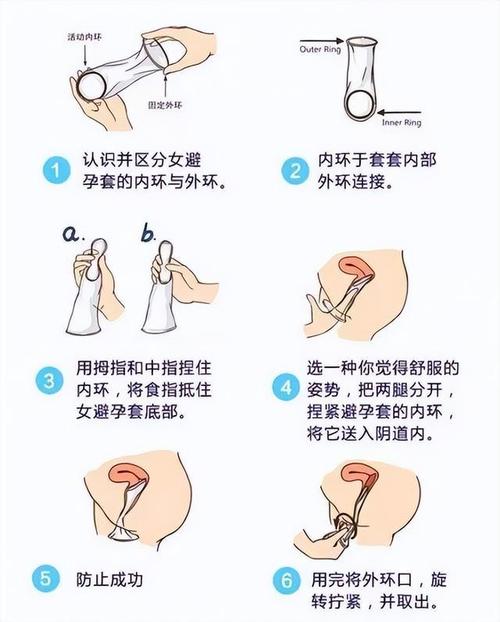 什么避孕方法最好最安全