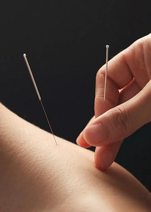 针灸能治疗气血不足吗