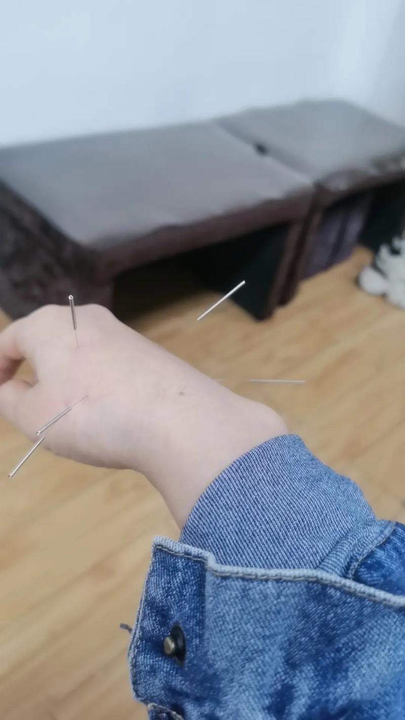 女性脚心受风针灸视频