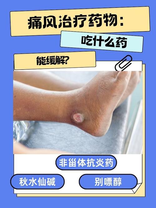 吃痛风药多久能要孩子