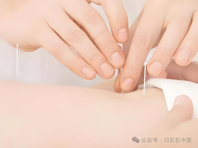 中华医药针灸减肥视频