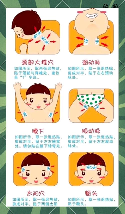 贴针灸退烧贴哪些部位