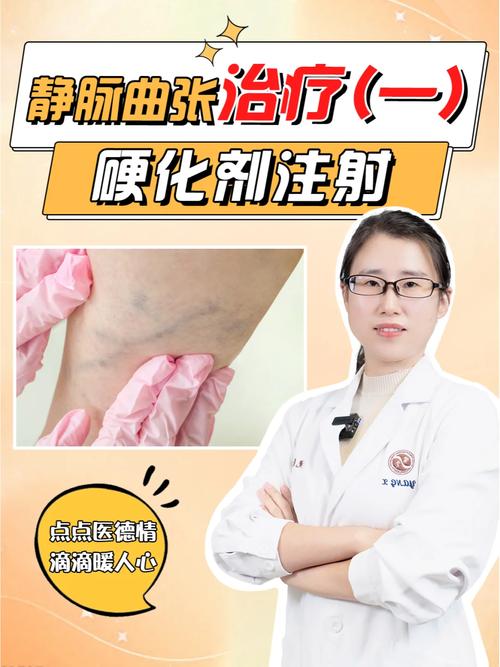 静脉曲张手术还是针灸