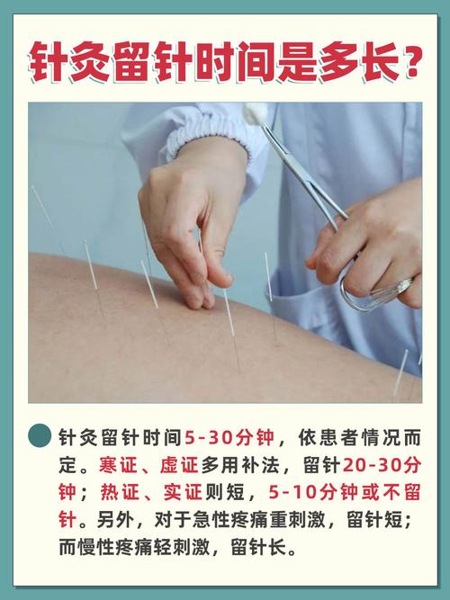 针灸做几个疗程有效果