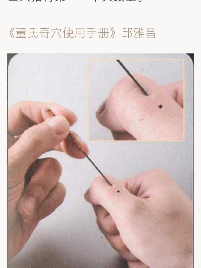 来月经可以针灸放血吗