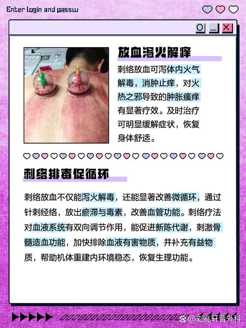 来月经可以针灸放血吗