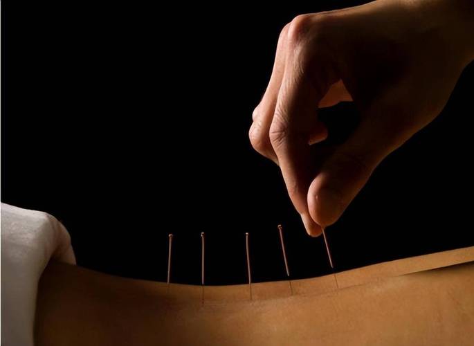 程莘农针灸视频腰腿痛