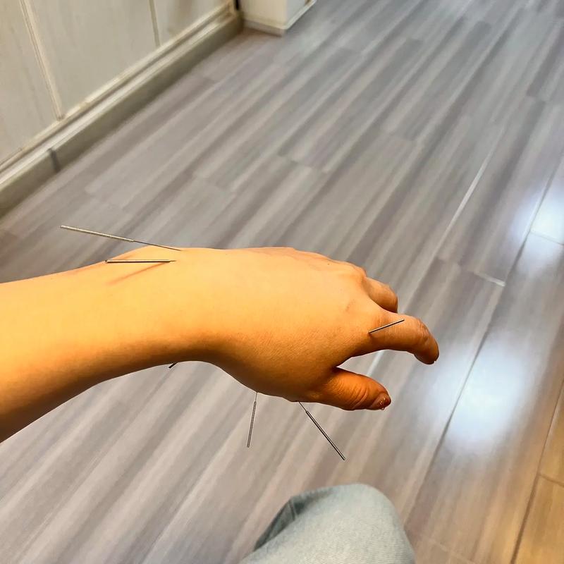 脚手肿大针灸怎么治疗