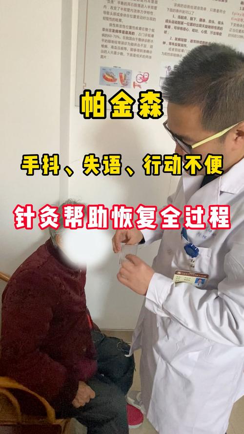 全息针帕金森针灸治疗