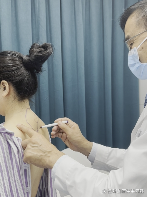 针灸甲状腺结节扎后背