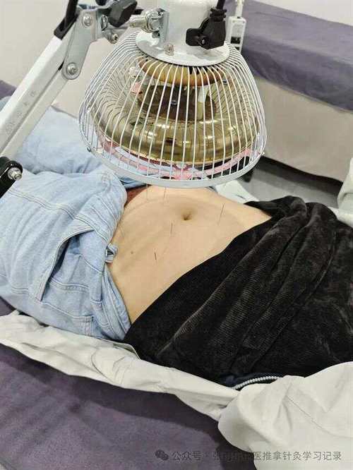 女人减肥针灸图片大全