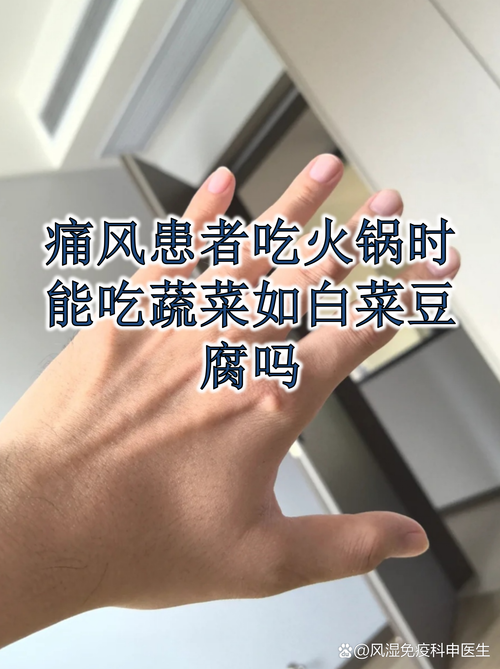 痛风病人可以吃火锅吗