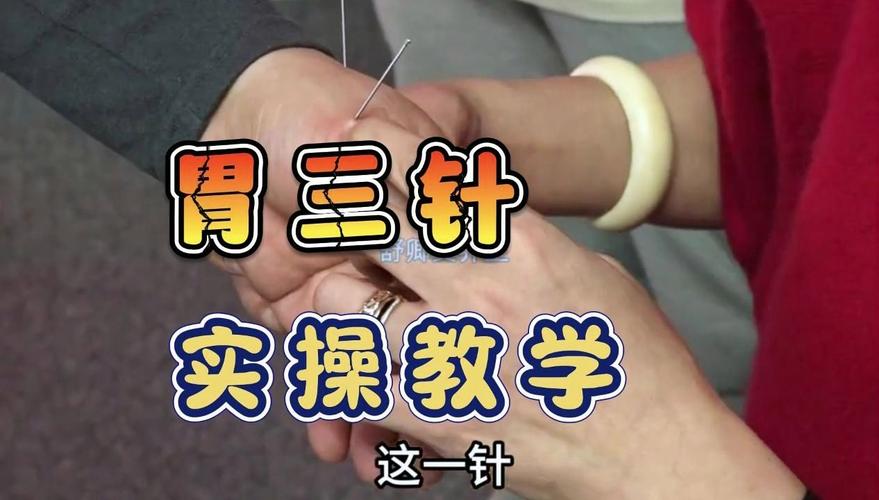 针灸调理肠胃多久见效