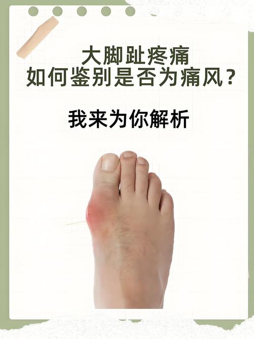 痛风时间长了会死人吗