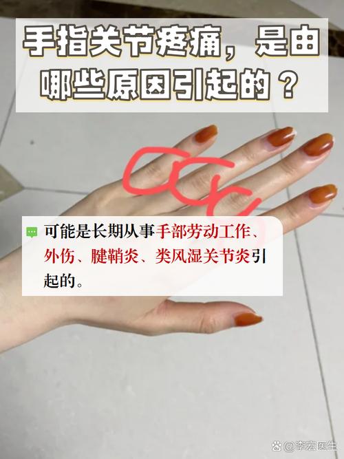 手指关节酸痛是痛风吗