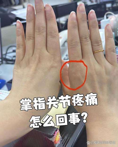 手指关节酸痛是痛风吗