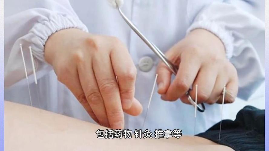 针灸可以治疗帕金森吗