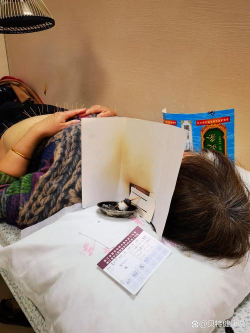 苏州哪里可以针灸治疗