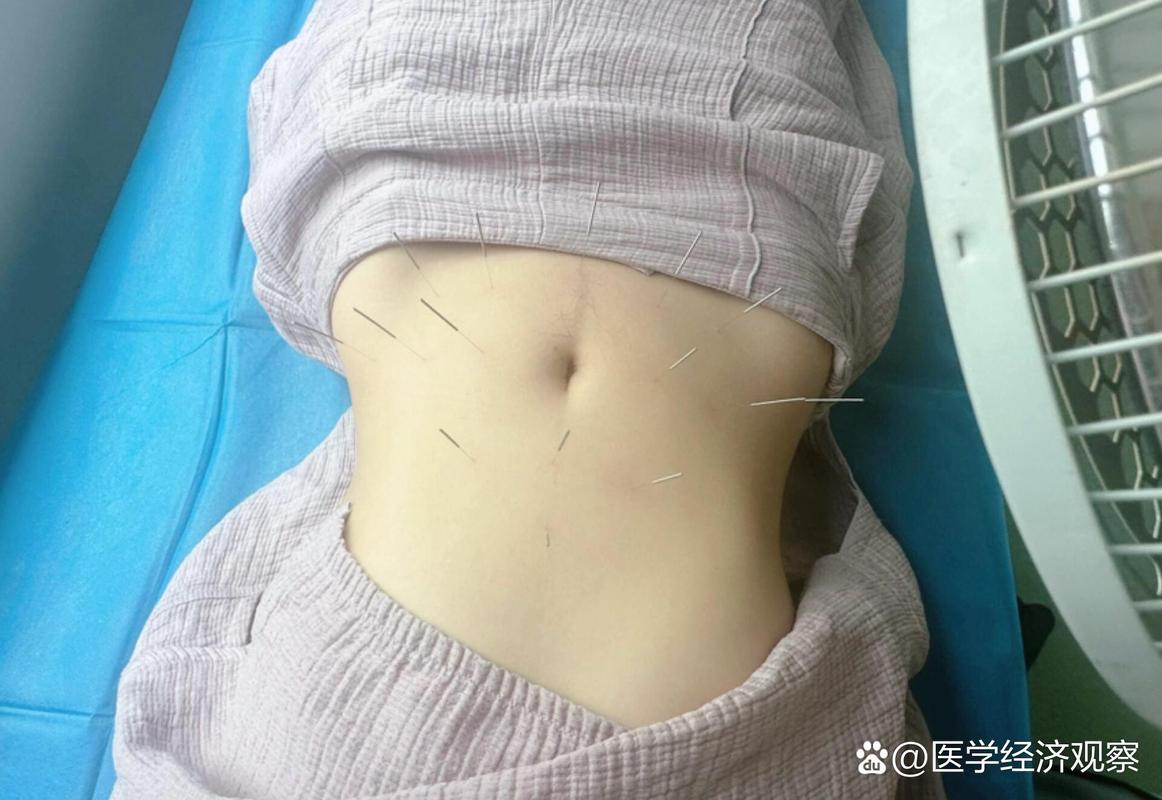 针灸治疗子宫肌瘤视频