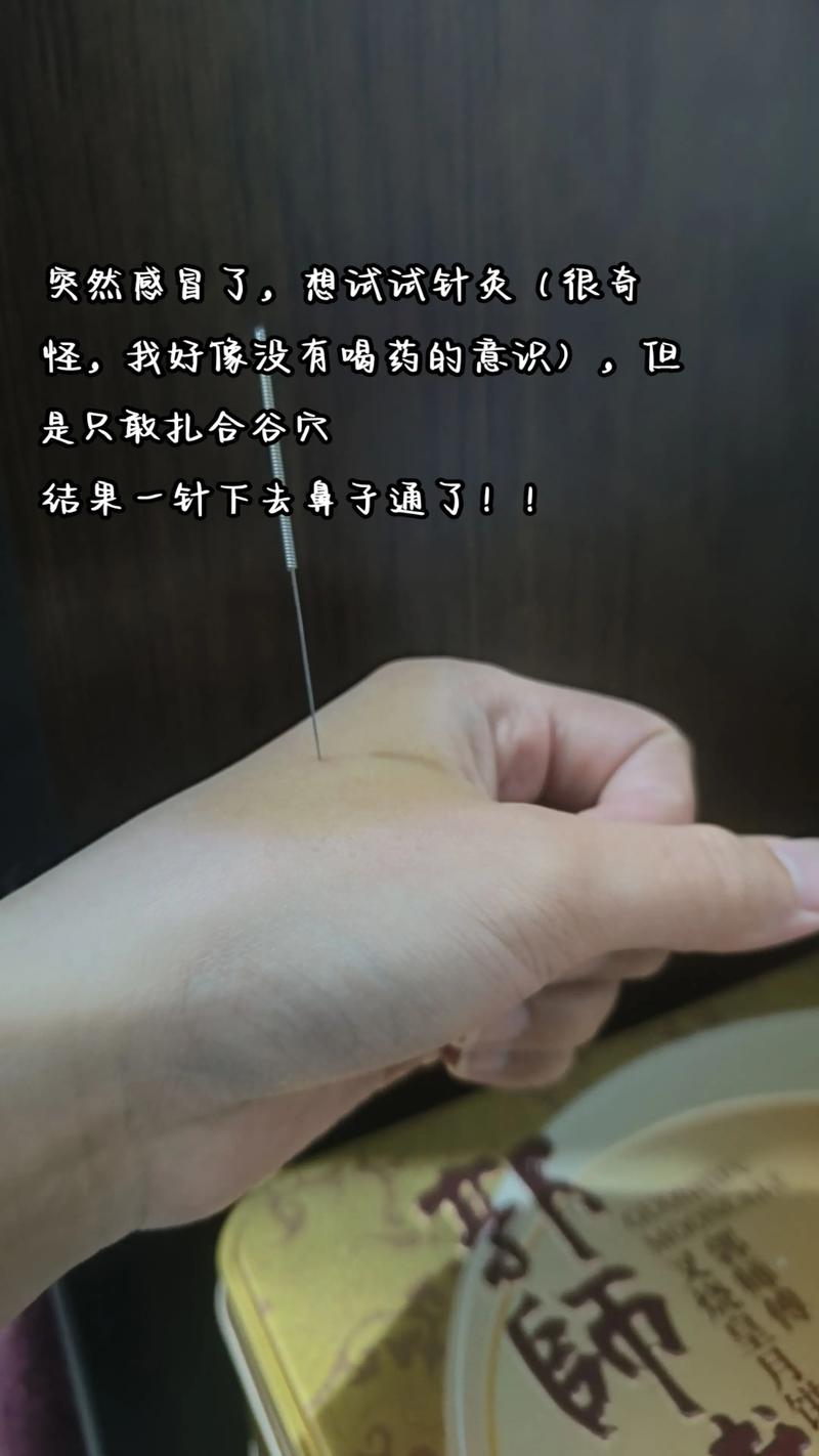 感冒发烧针灸哪些穴位