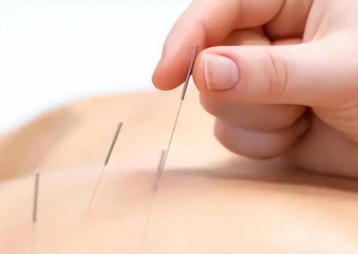 腹部硬结 点按 针灸