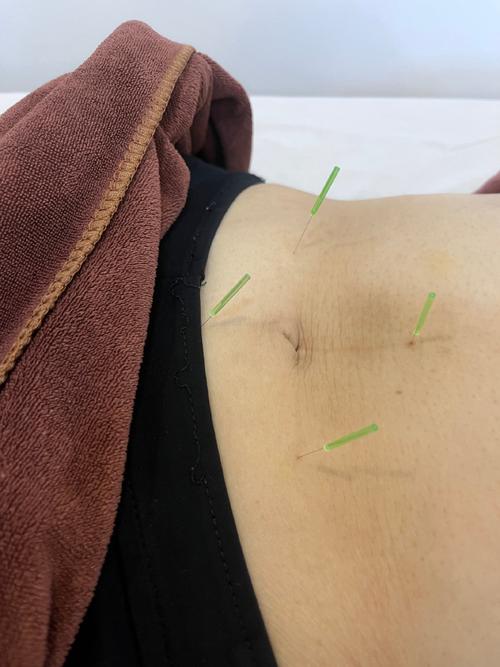 腹部硬结 点按 针灸